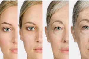 Improved Skin Texture