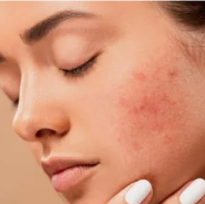 Organic moisturizers